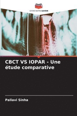 bokomslag CBCT VS IOPAR - Une tude comparative