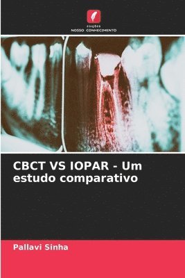 CBCT VS IOPAR - Um estudo comparativo 1