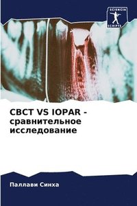 bokomslag Cbct Vs Iopar - ????????????? ????????????