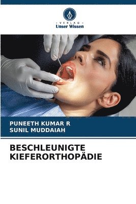 Beschleunigte Kieferorthopdie 1