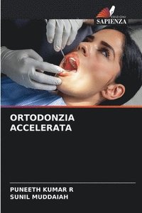 bokomslag Ortodonzia Accelerata