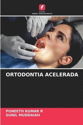 Ortodontia Acelerada 1