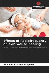 bokomslag Effects of Radiofrequency on skin wound healing