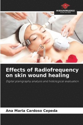 Effects of Radiofrequency on skin wound healing 1