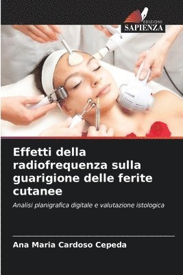 bokomslag Effetti della radiofrequenza sulla guarigione delle ferite cutanee