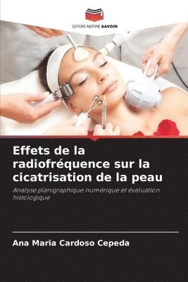 bokomslag Effets de la radiofrquence sur la cicatrisation de la peau