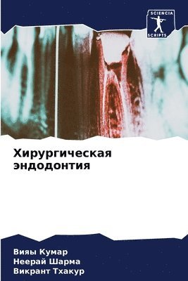 Вияы Кумар, Неерай Шарма, Викрант Тхакур, &#1 &#1050;&#1091;&#1084;&#1072;&#1088;, &#1 &#1064;&#1072;&#1088;&#1084;&#1072;, ¿¿¿¿ ¿¿¿¿¿, ¿¿¿¿¿¿ ¿¿¿¿¿, Viqy Kumar - Хирургическая эндодонтия, Häftad