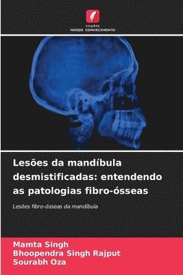 Leses da mandbula desmistificadas 1