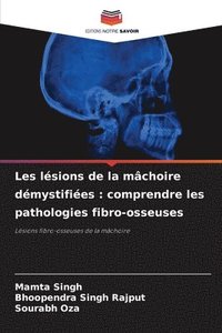 bokomslag Les lsions de la mchoire dmystifies