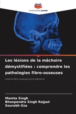 Mamta Singh, Bhoopendra Singh Rajput, Sourabh Oza - Les lésions de la mâchoire démystifiées, Häftad