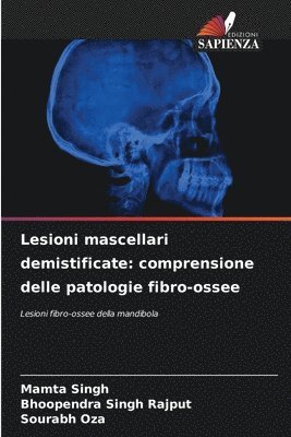 Lesioni mascellari demistificate 1