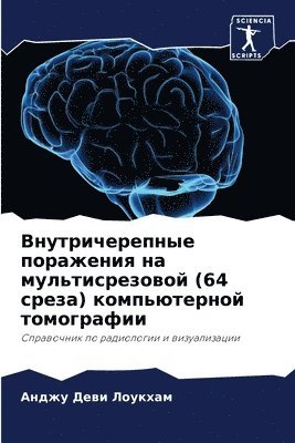 Внутричерепные поражения на мультисрезо&