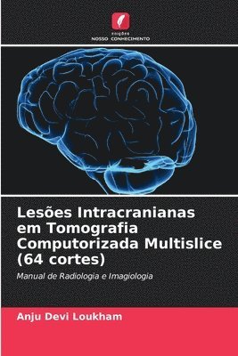 bokomslag Leses Intracranianas em Tomografia Computorizada Multislice (64 cortes)