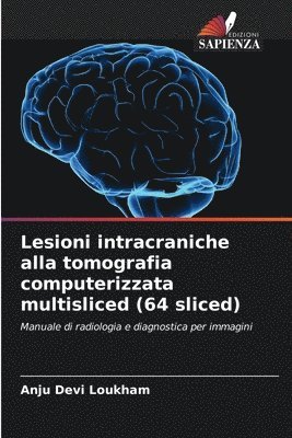 Lesioni intracraniche alla tomografia computerizzata multisliced (64 sliced) 1