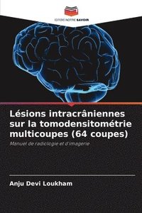 bokomslag Lésions intracrâniennes sur la tomodensitométrie multicoupes (64 coupes)
