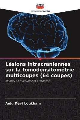 Lsions intracrniennes sur la tomodensitomtrie multicoupes (64 coupes) 1