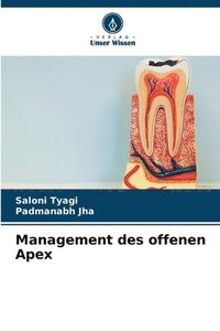 bokomslag Management des offenen Apex