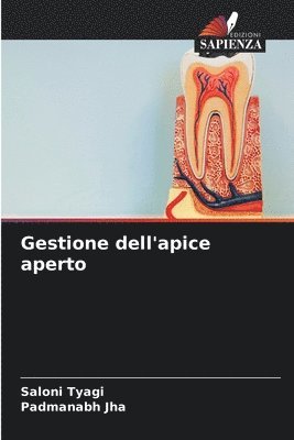 Saloni Tyagi, Padmanabh Jha - Gestione dell'apice aperto, Häftad