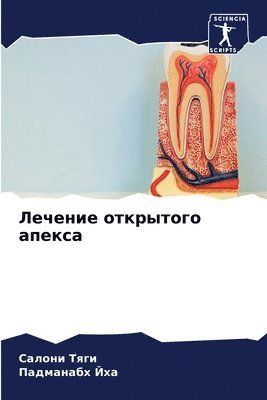 Салони Тяги, Падманабх Йха, &#1057;&#1 &#1058;&#1103;&#1075;&#1080;, &#1055;&#1072;&#1 &#1049;&#1093;&#1072;, ¿¿¿¿¿¿ ¿¿¿¿, ¿¿¿¿¿¿¿¿¿ ¿¿¿ - Лечение открытого апекса, Häftad