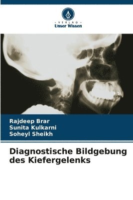 Diagnostische Bildgebung des Kiefergelenks