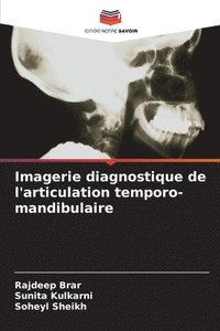 bokomslag Imagerie diagnostique de l'articulation temporo-mandibulaire