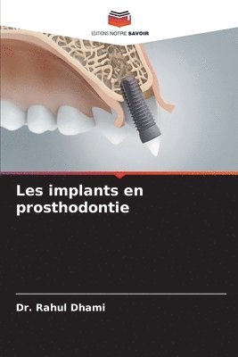 bokomslag Les implants en prosthodontie