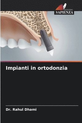 Impianti in ortodonzia 1