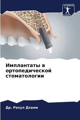 bokomslag &#1048;&#1084;&#1087;&#1083;&#1072;&#1085;&#1090;&#1072;&#1090;&#1099; &#1074; &#1086;&#1088;&#1090;&#1086;&#1087;&#1077;&#1076;&#1080;&#1095;&#1077;&#1089;&#1082;&#1086;&#1081;