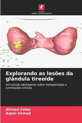 Explorando as leses da glndula tireoide 1