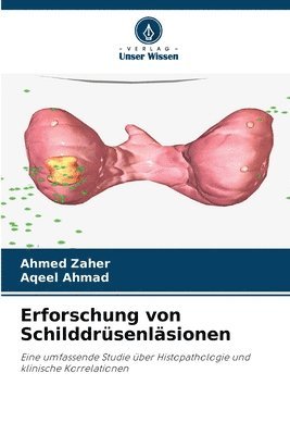 Erforschung von Schilddrüsenläsionen