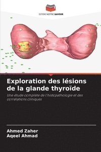 bokomslag Exploration des lsions de la glande thyrode