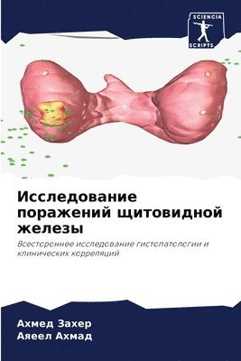 bokomslag &#1048;&#1089;&#1089;&#1083;&#1077;&#1076;&#1086;&#1074;&#1072;&#1085;&#1080;&#1077; &#1087;&#1086;&#1088;&#1072;&#1078;&#1077;&#1085;&#1080;&#1081;