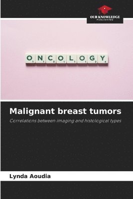 Malignant breast tumors 1