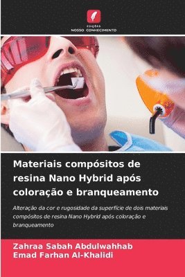 Zahraa Sabah Abdulwahhab, Emad Farhan Al-Khalidi - Materiais compósitos de resina Nano Hybrid após coloração e branqueamento, Häftad