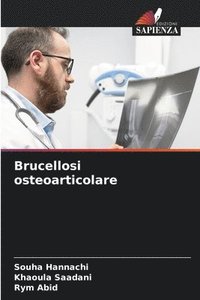 bokomslag Brucellosi osteoarticolare