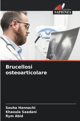 Brucellosi osteoarticolare 1