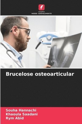 bokomslag Brucelose osteoarticular