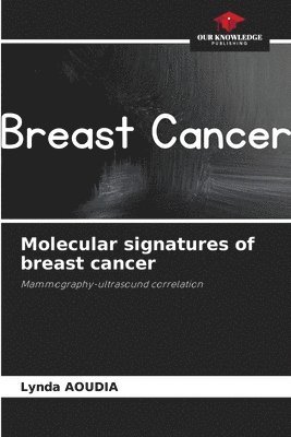 Molecular signatures of breast cancer 1