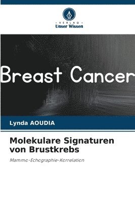 bokomslag Molekulare Signaturen von Brustkrebs