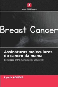 bokomslag Assinaturas moleculares do cancro da mama