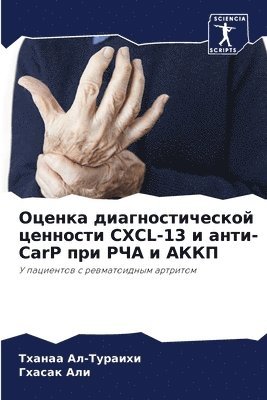 Оценка диагностической ценности CXCL-13 и анти-CarP