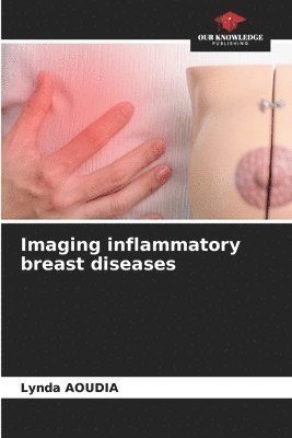 bokomslag Imaging inflammatory breast diseases