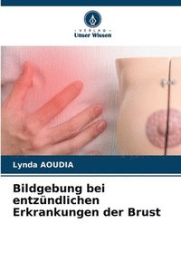 bokomslag Bildgebung bei entzndlichen Erkrankungen der Brust