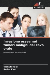 bokomslag Invasione ossea nei tumori maligni del cavo orale