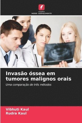 Invaso ssea em tumores malignos orais 1