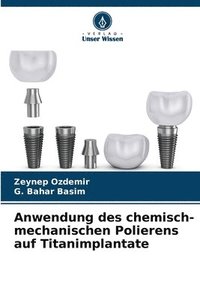 bokomslag Anwendung des chemisch-mechanischen Polierens auf Titanimplantate