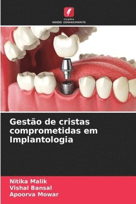 bokomslag Gesto de cristas comprometidas em Implantologia