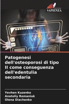 bokomslag Patogenesi dell'osteoporosi di tipo II come conseguenza dell'edentulia secondaria