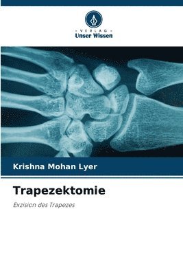 Trapezektomie 1