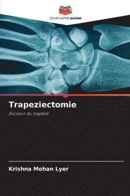 bokomslag Trapeziectomie